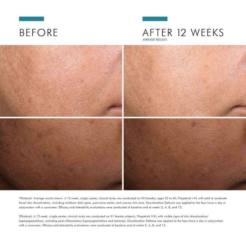 Discoloration Defense - Shop SkinCeuticals in Shreveport 