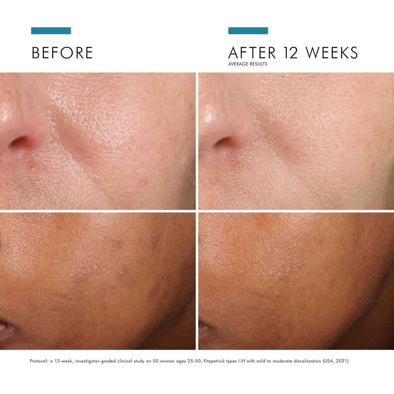 SkinCeuticals Phloretin CF - Pennington Facial Plastics